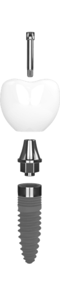 Implants - Flexible & Comfortable