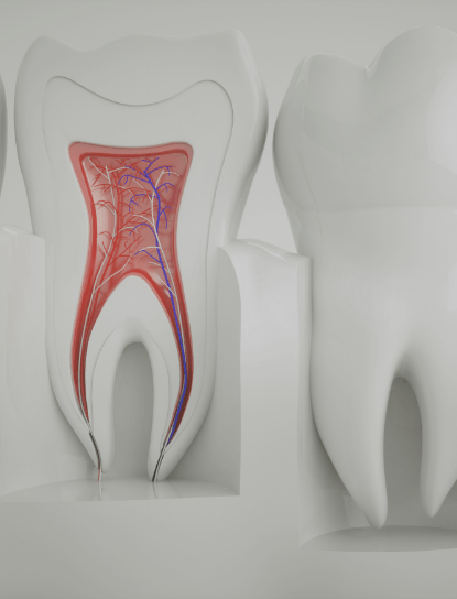 Root Canal