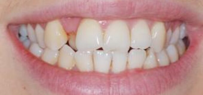 Before - seasidedental