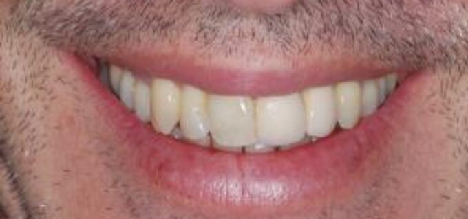 After - seasidedental