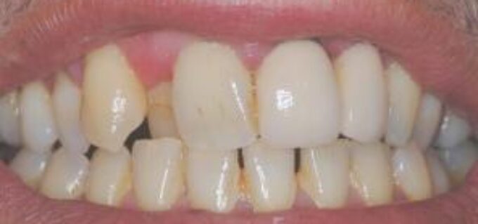 Before - seasidedental